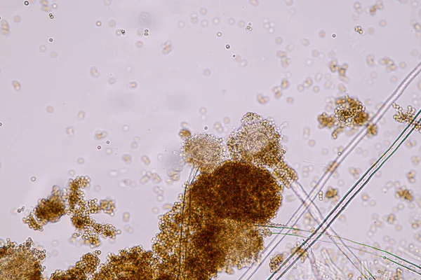 Aspergillus Niger Und Aspergillus Oryzae Schimmelpilz Unter Dem Mikroskop Für — Stockfoto