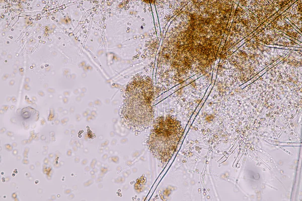 Aspergillus Niger Aspergillus Oryzae Plíseň Pod Mikroskopem Pro Mikrobiologii Laboratoři — Stock fotografie