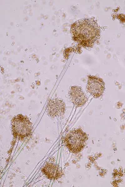 Aspergillus Niger Aspergillus Oryzae Pleśń Pod Mikroskopem Mikrobiologii Laboratorium — Zdjęcie stockowe