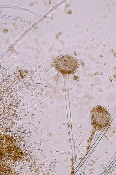 Aspergillus Niger Και Aspergillus Oryzae Μούχλα Στο Μικροσκόπιο Για Μικροβιολογία — Φωτογραφία Αρχείου