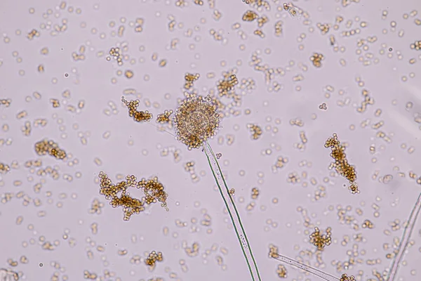 Aspergillus Niger Aspergillus Oryzae Mofo Sob Microscópio Para Microbiologia Laboratório — Fotografia de Stock
