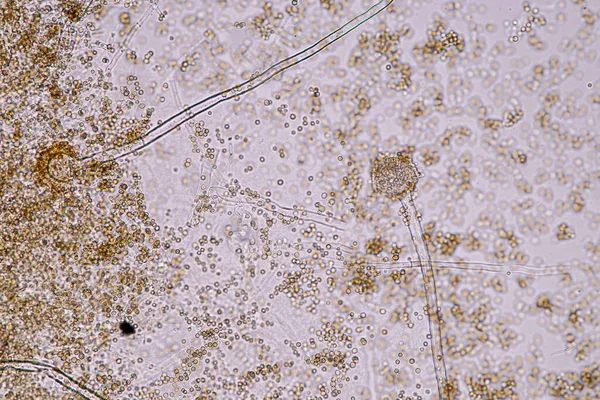 Aspergillus Niger Aspergillus Oryzae Mofo Sob Microscópio Para Microbiologia Laboratório — Fotografia de Stock