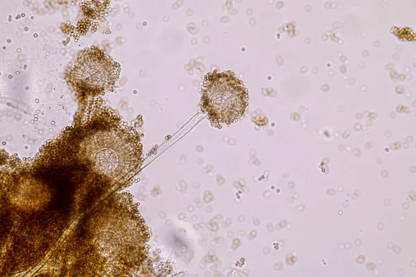 Aspergillus Niger Aspergillus Oryzae Плісень Під Мікроскопом Мікробіології Лабі — стокове фото