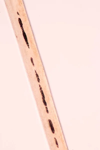 Charakteristika Vlasové Buňky Člověka Pod Mikroskopem Pro Výuku Laboratoři — Stock fotografie