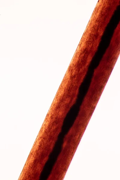 Características Célula Capilar Humana Bajo Microscopio Ver Para Educación Laboratorio — Foto de Stock