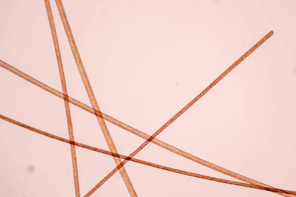 Характеристики Клітин Волосся Людини Під Мікроскопом Навчання Лабораторії — стокове фото