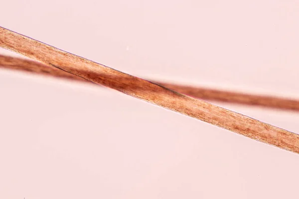 Merkmale Menschlicher Haarzellen Unter Dem Mikroskop Für Die Ausbildung Labor — Stockfoto