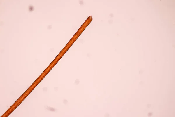 Caratteristiche Della Cellula Capillare Dell Uomo Microscopio Educazione Laboratorio — Foto Stock