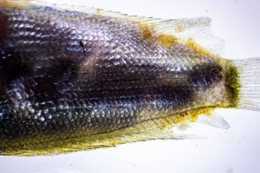 Parazit (Clinostomum sp. ), Clinostomum sp. mikroskop altında .