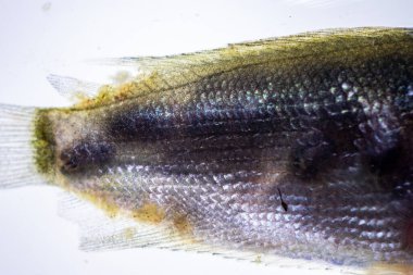 Parazit (Clinostomum sp. ), Clinostomum sp. mikroskop altında .