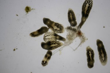 Parazit (Clinostomum sp. ), Clinostomum sp. mikroskop altında .