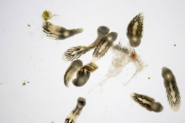 Parazit (Clinostomum sp. ), Clinostomum sp. mikroskop altında .