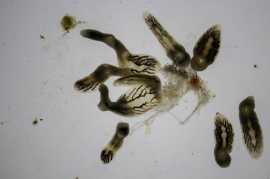 Parasitic (Clinostomum sp.), Study of Clinostomum sp. under microscope view .