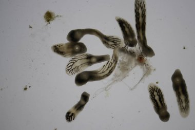 Parazit (Clinostomum sp. ), Clinostomum sp. mikroskop altında .