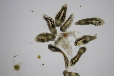 Parazit (Clinostomum sp. ), Clinostomum sp. mikroskop altında .