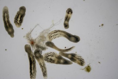 Parazit (Clinostomum sp. ), Clinostomum sp. mikroskop altında .