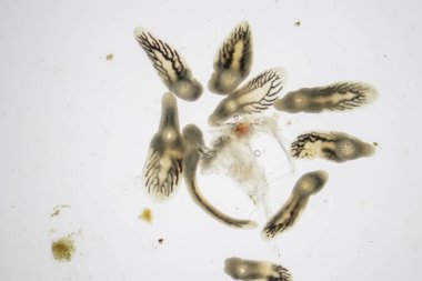 Parazit (Clinostomum sp. ), Clinostomum sp. mikroskop altında .