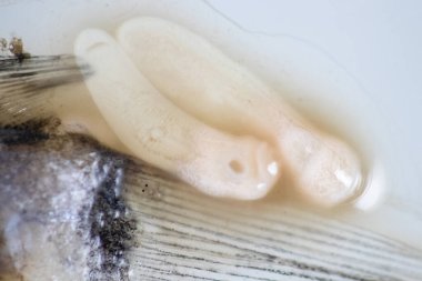 Parazit (Clinostomum sp. ), Clinostomum sp. mikroskop altında .