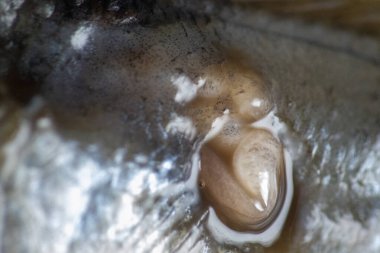 Parazit (Clinostomum sp. ), Clinostomum sp. mikroskop altında .