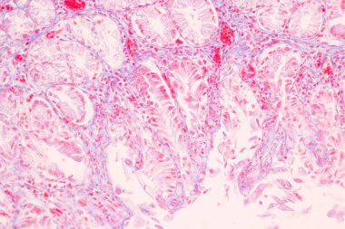 Laboratuvarda mikroskop altında Mide İnsanı dokusu.