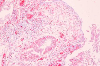 Laboratuvarda mikroskop altında Mide İnsanı dokusu.