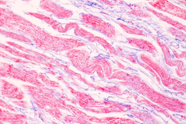 Laboratuvarda mikroskop altında Mide İnsanı dokusu.