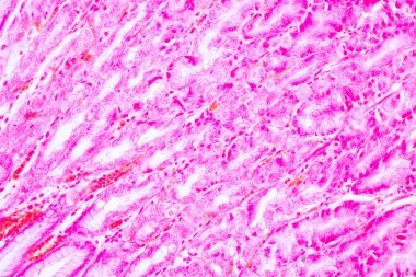 Laboratuvarda mikroskop altında Mide İnsanı dokusu.