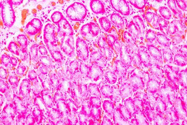 Laboratuvarda mikroskop altında Mide İnsanı dokusu.