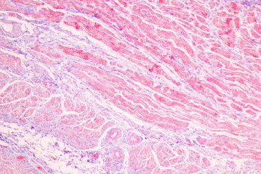 Laboratuvarda mikroskop altında Mide İnsanı dokusu.