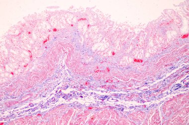 Laboratuvarda mikroskop altında Mide İnsanı dokusu.