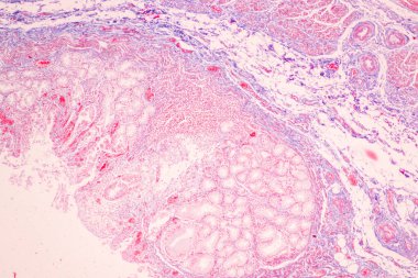Laboratuvarda mikroskop altında Mide İnsanı dokusu.