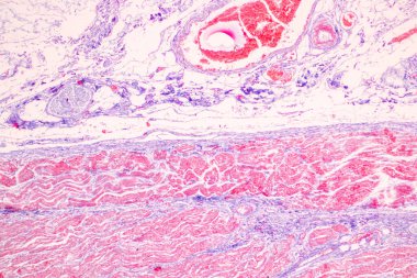 Laboratuvarda mikroskop altında Mide İnsanı dokusu.