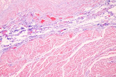 Laboratuvarda mikroskop altında Mide İnsanı dokusu.