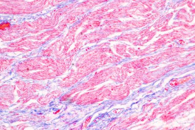 Laboratuvarda mikroskop altında Mide İnsanı dokusu.