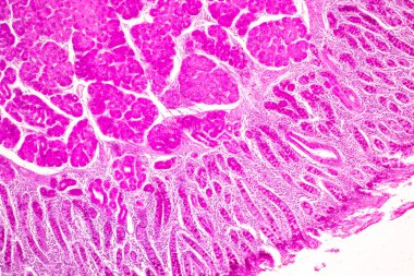 Laboratuvarda mikroskop altında İnce bağırsak (Duodenum) ve Vermiform Apandisit İnsanı dokusu.