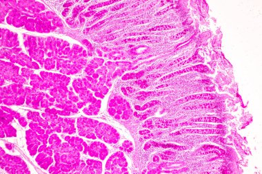 Laboratuvarda mikroskop altında İnce bağırsak (Duodenum) ve Vermiform Apandisit İnsanı dokusu.