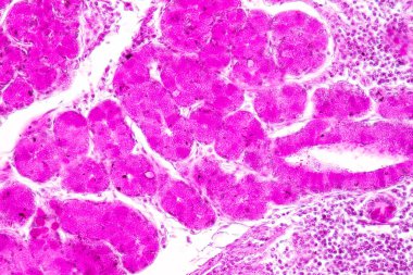 Laboratuvarda mikroskop altında İnce bağırsak (Duodenum) ve Vermiform Apandisit İnsanı dokusu.