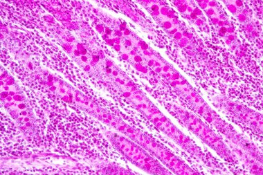 Laboratuvarda mikroskop altında İnce bağırsak (Duodenum) ve Vermiform Apandisit İnsanı dokusu.