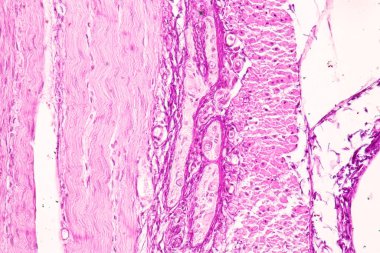 Laboratuvarda mikroskop altında İnce bağırsak (Duodenum) ve Vermiform Apandisit İnsanı dokusu.