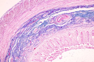 Laboratuvarda mikroskop altında İnce bağırsak (Duodenum) ve Vermiform Apandisit İnsanı dokusu.