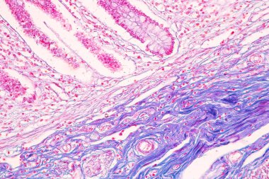 Laboratuvarda mikroskop altında İnce bağırsak (Duodenum) ve Vermiform Apandisit İnsanı dokusu.