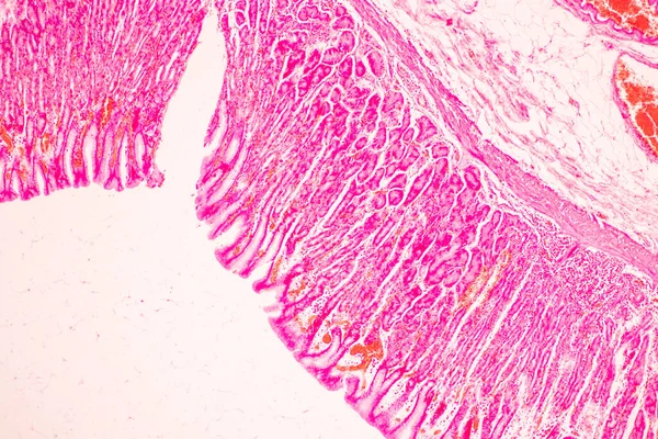 Tkáň Žaludku Člověka Pod Mikroskopem Laboratoři — Stock fotografie