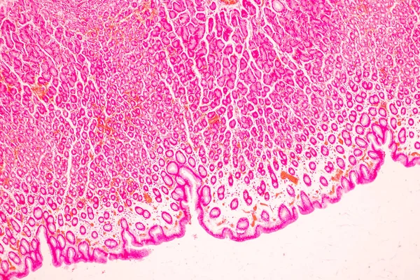 Vävnad Magsäcken Människa Mikroskop Lab — Stockfoto