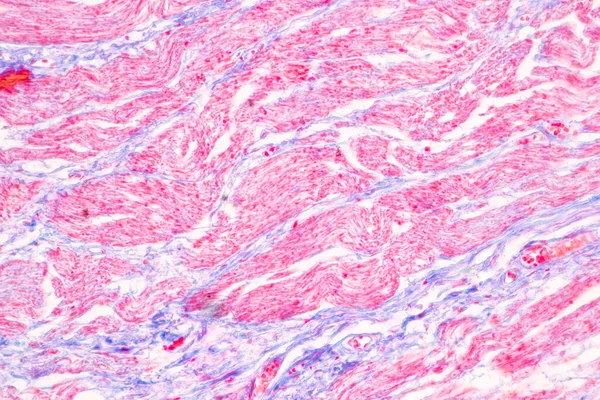 Laboratuvarda mikroskop altında Mide İnsanı dokusu.