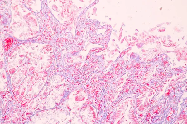 Tissue Stomach Human Microscope Lab — 스톡 사진