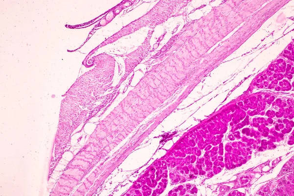 Tecido Intestino Delgado Duodeno Apêndice Vermiforme Humano Microscópio Laboratório — Fotografia de Stock