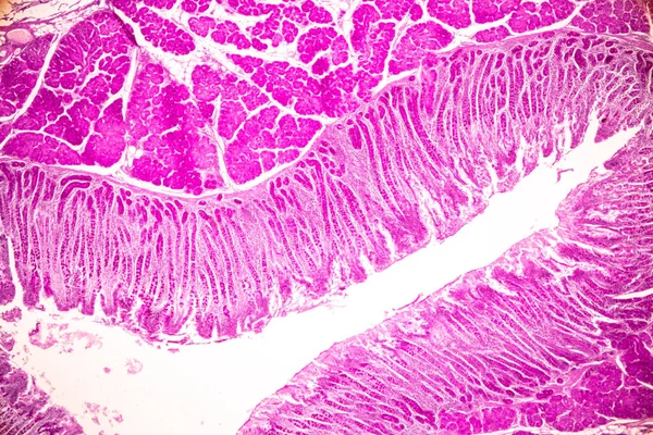 实验室显微镜下小肠组织 Duodenum 和畸形性阑尾的实验研究 — 图库照片