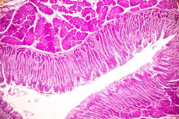Тканина Тонкого Кишечника Duodenum Вермішель Людина Під Мікроскопом Лабораторії — стокове фото