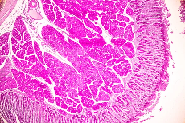 小腸の組織 十二指腸 とベルミフォーム虫垂研究室の顕微鏡下でヒト — ストック写真