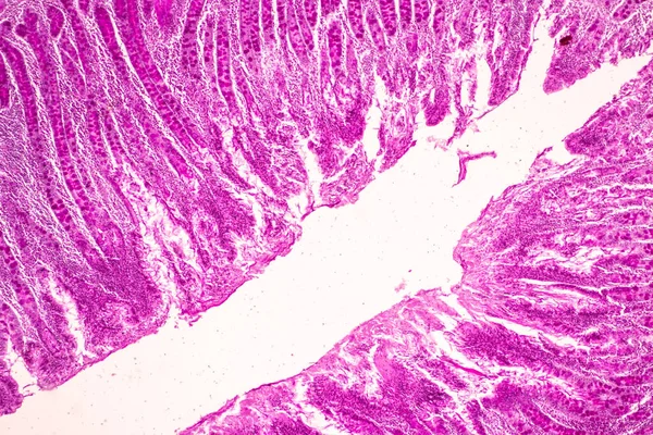 Weefsel Van Dunne Darm Duodenum Vermiform Appendix Human Onder Microscoop — Stockfoto